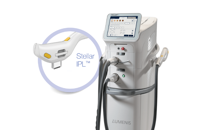 ¿Qué es el sistema LUMENIS M22 / STELLAR M22?