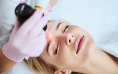 ¿Para qué sirve y cómo transforma tu piel el láser CO2 fraccionado?