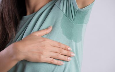 Sudoración excesiva en verano: cuándo puede ser hiperhidrosis y cómo tratarla